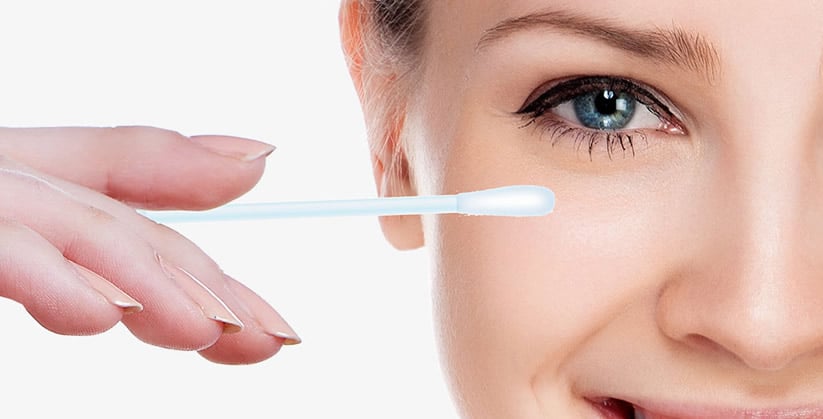 cauterização química single