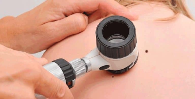 dermatoscopia single