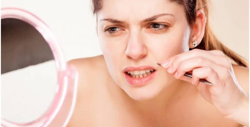 hirsutismo aumento pelos single