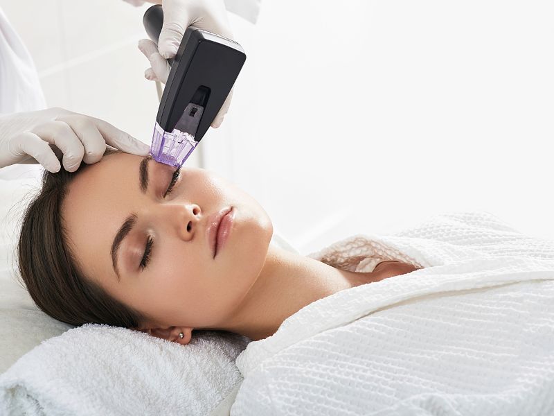 profissional qualificado Radiofrequência Microagulhada