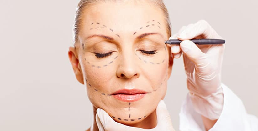 LIFTING FACIAL (REJUVENESCIMENTO FACIAL)