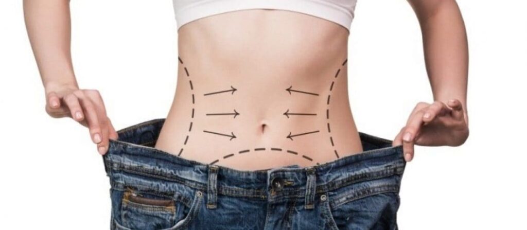 Pós Bariátrica em Brasília