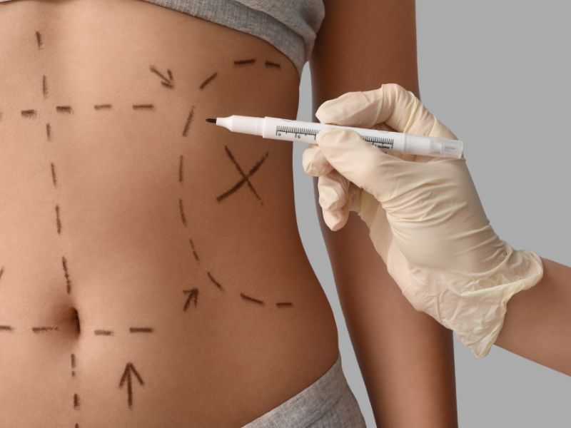 consulta com cirurgião plástico