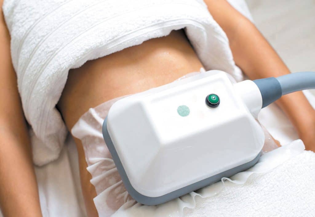 criolipólise para quem é indicado