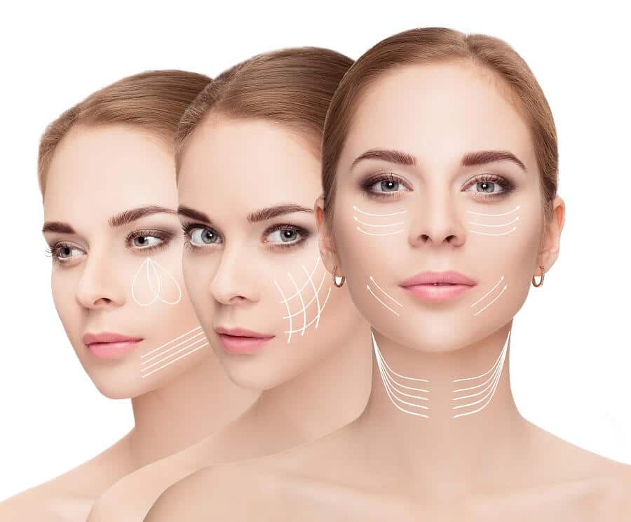 lifting facial Brasilia