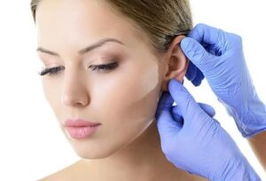 Otoplastia: o que é e como pode melhorar a sua aparência