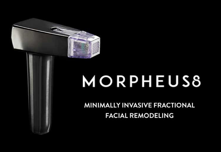 E-um-procedimento-minimamente-invasivo-que-combina-a-radiofrequencia-fracionada-com-microagulhamento