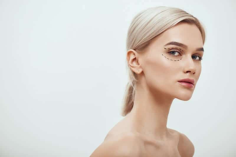 A blefaroplastia visa melhorar a aparência das pálpebras.