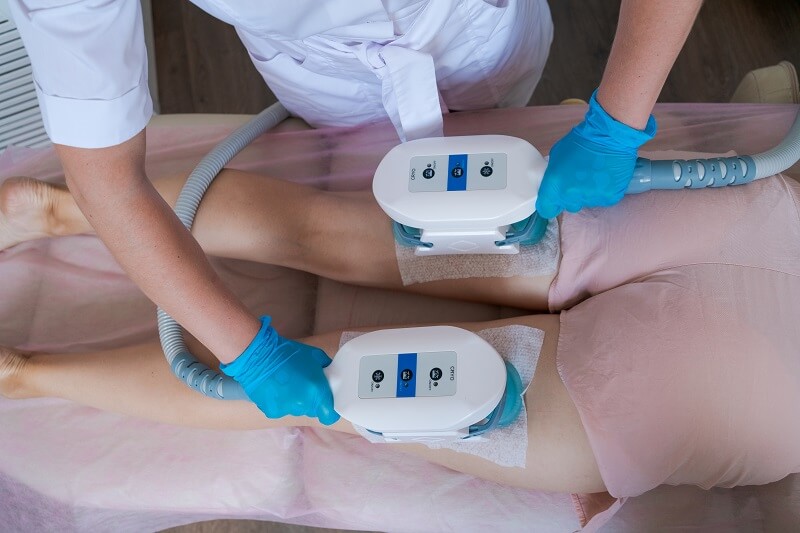 Saiba tudo sobre o Coolsculpting