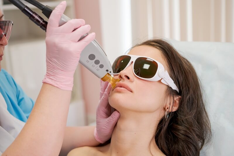 Laser na Dermatologia Estética